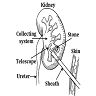 Laparoscopic